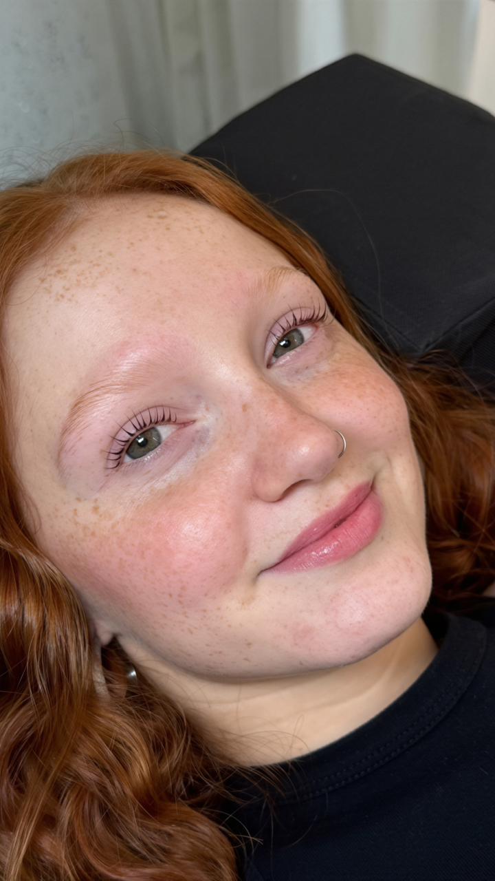 Lifting coreano — vista lateral del resultado